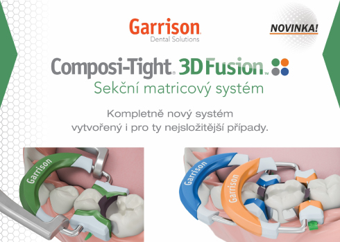 NOVINKA: Kompletní sekční matricový systém 3D FUSION